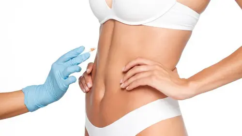 plastica dopo l'incavatura